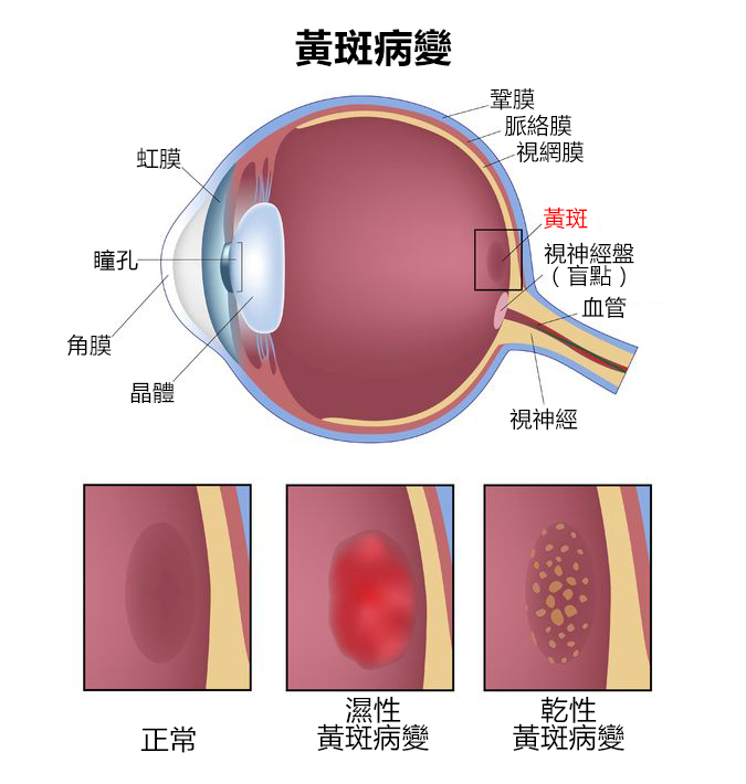 眼底黄斑病专项诊疗